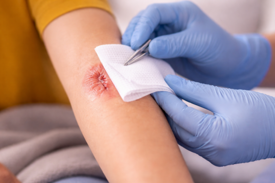 Suivi blessure 